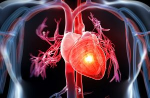 Sodium không tốt cho người mắc bệnh tim mạch